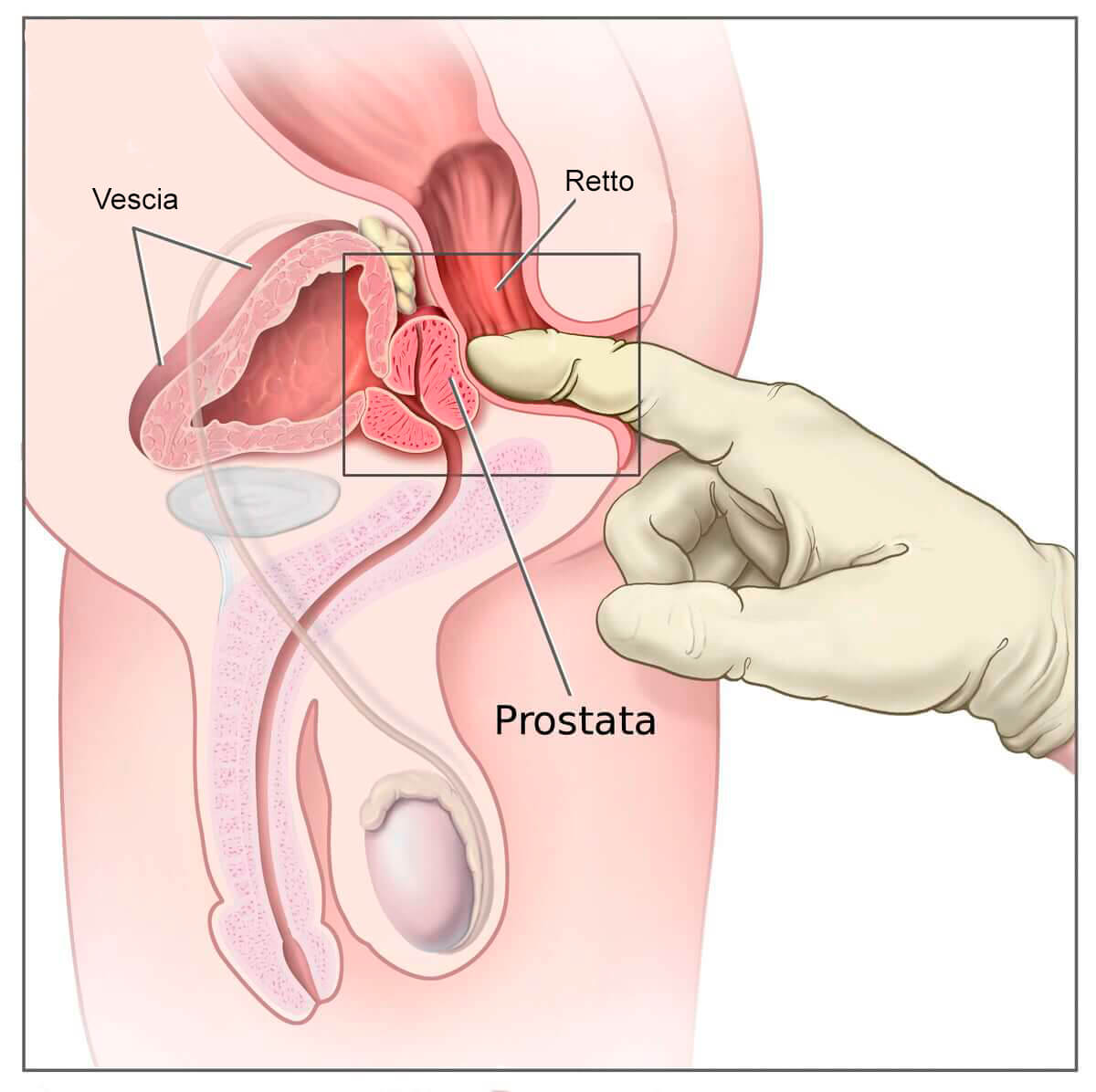 prostata ingrossata farmaco Vérvér a prosztatitis alatt